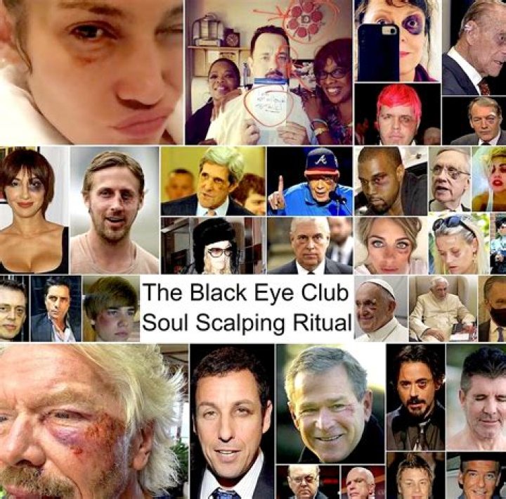 Unraveling the Black Eye Conspiracy: Myths, Realities, and Cultural Impact