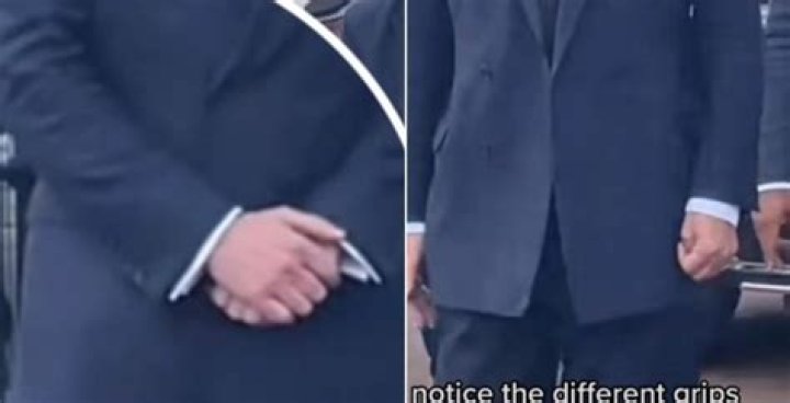 Understanding the Bodyguard Fake Hand: A Comprehensive Guide to Its Use and Significance