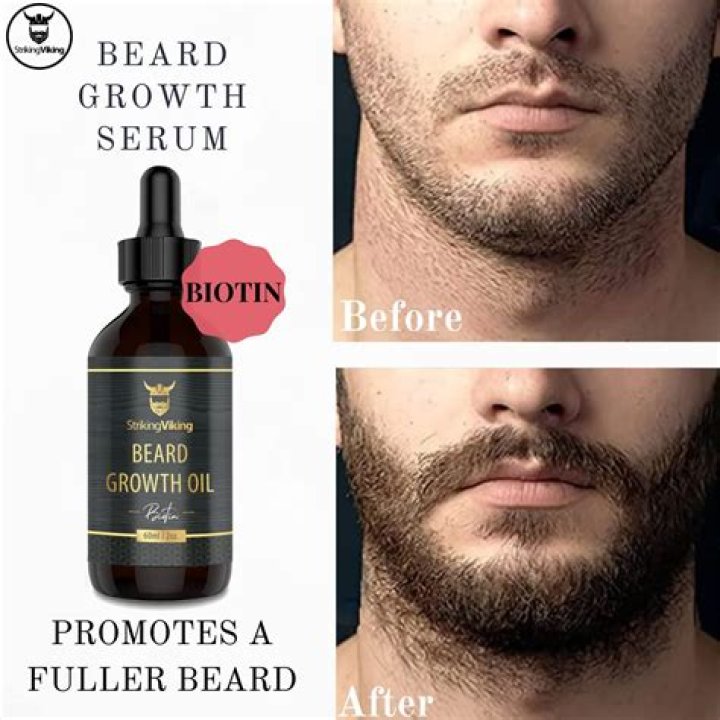 Does Oil Help Beard Growth? Unlocking the Secrets for a Fuller Beard