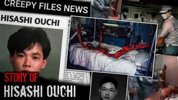 Hisashi Ouchi Real Photos: Unveiling the Truth Behind the Tragic Story