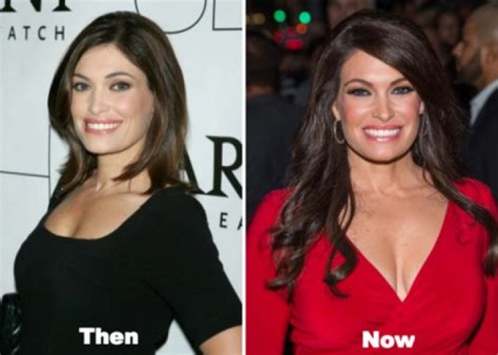 Kimberly Guilfoyle Plastic Surgery Photos: A Comprehensive Insight into Her Transformation