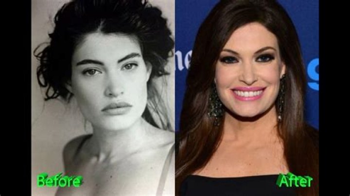 Kimberly Guilfoyle Surgery: Insights, Impact, and Recovery Journey