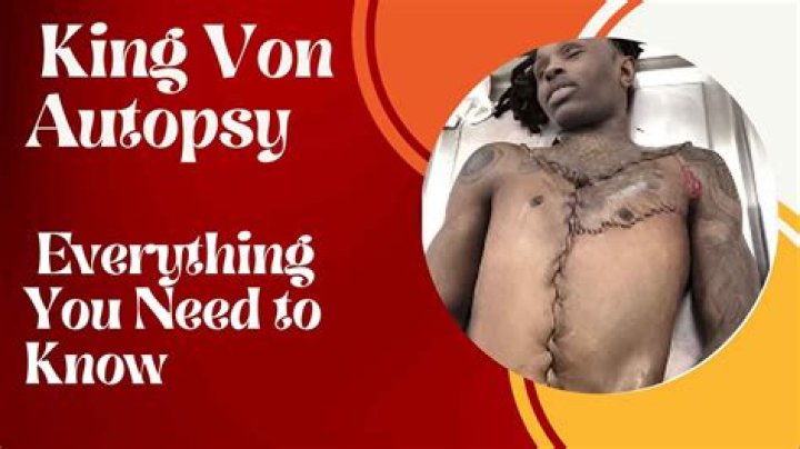 King Von Autopsy Photos: Unveiling the Truth Behind the Tragic Death of a Rising Star