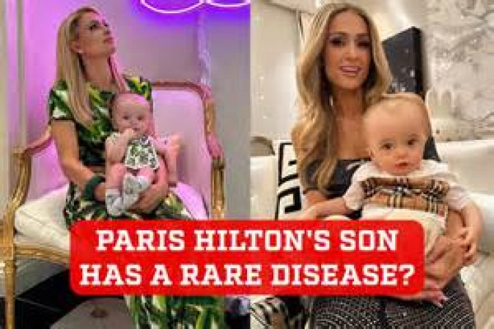 Understanding Paris Hilton's Son's Condition: A Deep Dive into Parenting, Health, and Family Dynamics