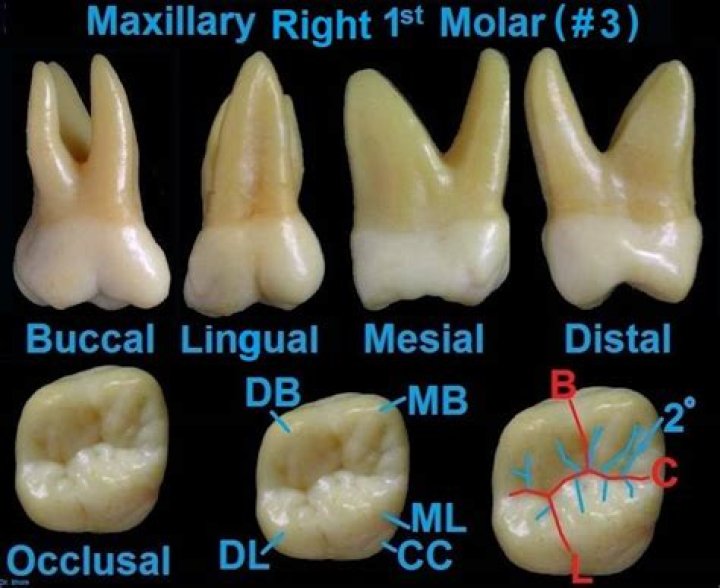 Comprehensive Guide to Upper Molar Root: Understanding Its Structure, Function, and Health